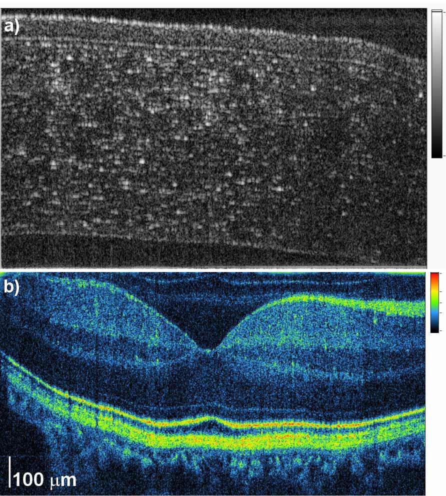 Fig. 8. Cross-sectional images of human eye in vivo obtained by the SOCT system using optical frequency comb for M = 1.