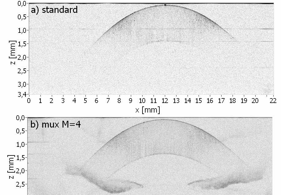 To demonstrate the applicability of the multiplexing method, we examined the anterior chamber of porcine eye in vitro. Figure 10(a) shows a result obtained by standard SOCT technique.