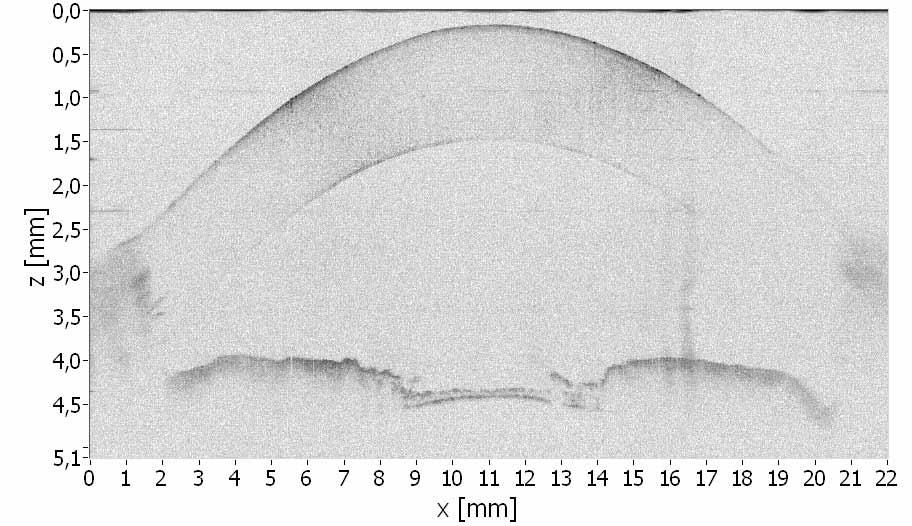 Fig. 11. Cross-sectional image of the anterior chamber of porcine eye in vitro obtained by multiplexing SOCT technique with M = 6.