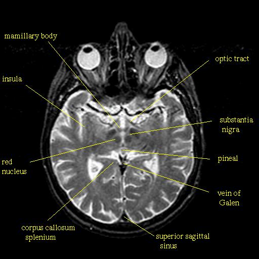 Medical Images: MRI of