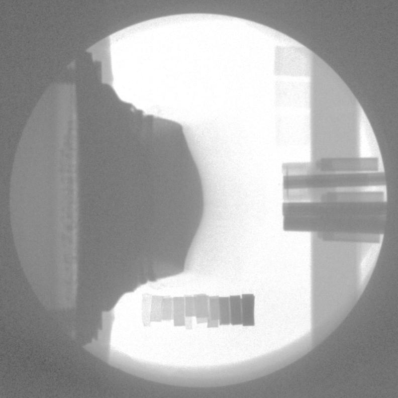 image Dynamic X-ray image Ejecta