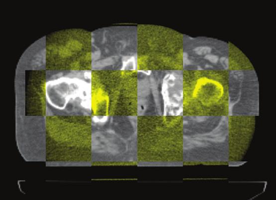 Prostate visibility No high-z artifact Multi-planar image overlay Overlay images, structures, dose Common imaging and treatment subsystem 8.