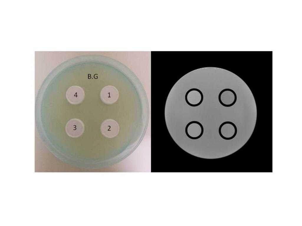 Images for this section: Fig. 1: The photograph (left) and T2WI image (right) of DWI-phantom. The hemispherical plastic bottle was filled with 1.42 w/v % agar gel.