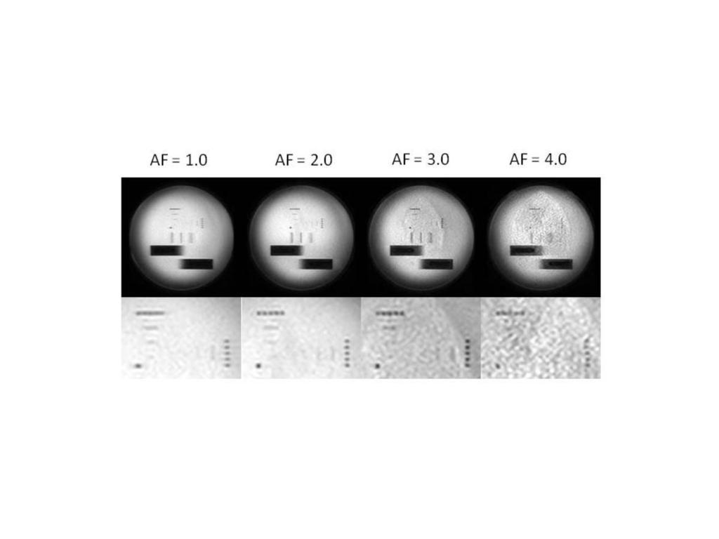 Imaging Diagnostics, Shizuoka Cancer Center - Shizuoka/JP Fig. 4: The pin phantom images (upper row) and magnitude images (lower row).