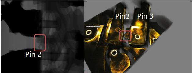 Figure 6: 2D X-ray and 3D X-ray tomography images showing the tin filament that was found to cause the electrical short.