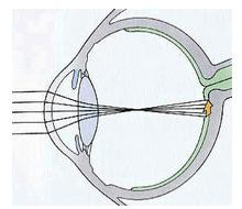 It is the second part of your eye, after the cornea, that helps to focus light and images on your retina.