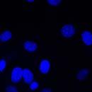 ) Clear separation of fluorescent dyes without the danger
