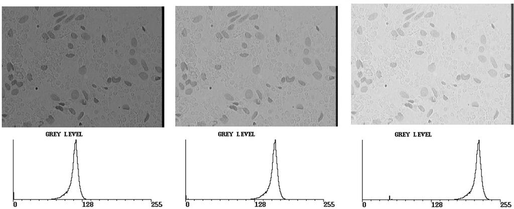 Image Histograms A gray level histogram shows how many pixels there are at each intensity level.
