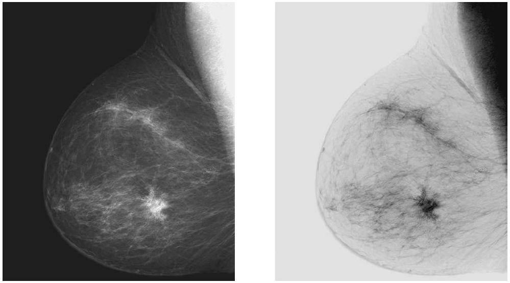 Gray Level Transformations Negative or positive 13/34 Gray Level Transformations Log transformations 14/34 Original digital mammogram (left).