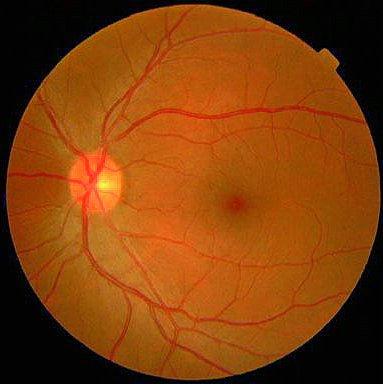 covers 65% of the eyeball s inner surface it contains photo- sensitive rod and cone cells the complex network of blood vessels in the retina are unique for each individual this pattern remains