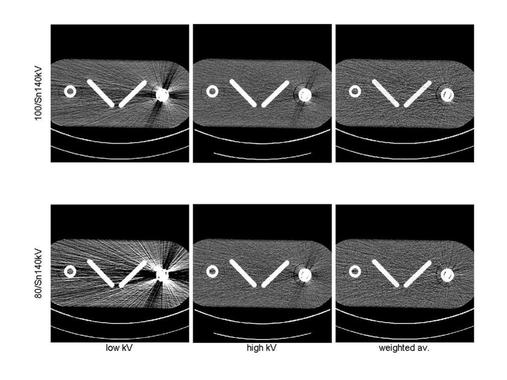 Fig.: Metal artifacts by hip prosthesis phantom for all voltage combinations (rows), the two original images (left, middle) and the weighted average image (right).