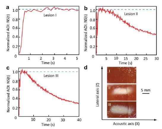 Region of interest monitoring AO signals used to monitor volume of tissue necrosis