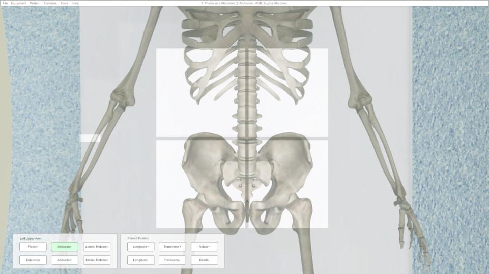 8 Skeleton view Under the Tools menu you can enable a bone view. (Alternatively Ctrl + 8) This allows you to interact with the bony landmarks that are normally palpated.