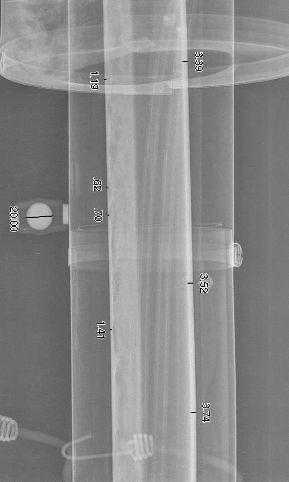 Computed Radiography (CR) in the oil and gas industry In-service inspection of pipes Flaws of interest generally corrosion & erosion Can be internal or external Corrosion product often present for