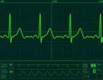 Electrocardiogram (ECG) and Blood Oximetry
