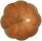 ratio, neuroretinal rim area and rim to disk area along with many others.