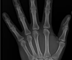 Considerations for Displaying Medical Images The matrix size of a radiographic image is often much greater than display matrix size In order to view the whole projection