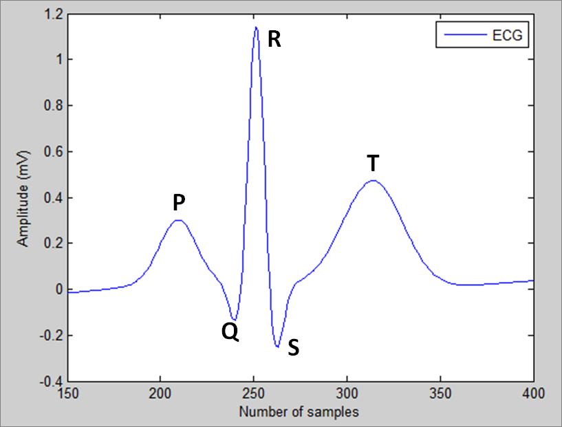 Figure 3.2: An ECG sample obtained from Physionet marked with its P, QRScomplex, and T points. The ECG signal is used to observe the electrical activity of the heart over a period of time.
