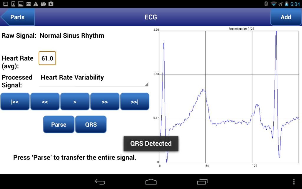 Figure 4.6: ECG Signal Generator block displaying a normal sinus rhythm. Figure 4.
