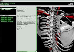Google Earth for the Body - by IBM Allows doctors to
