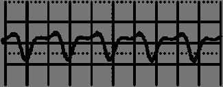1 =      Output Ripple & Noise Output Load Transient Response Output