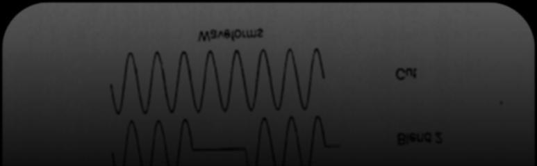 Modes The device has several modes: Cut mode Pure sine wave, for cutting with the least coagulation.