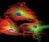 Powerful results from advanced confocal imaging Image processing and analyses functions Triple staining Cell motility A wide variety of processing filters are available including Median, Low-Pass,