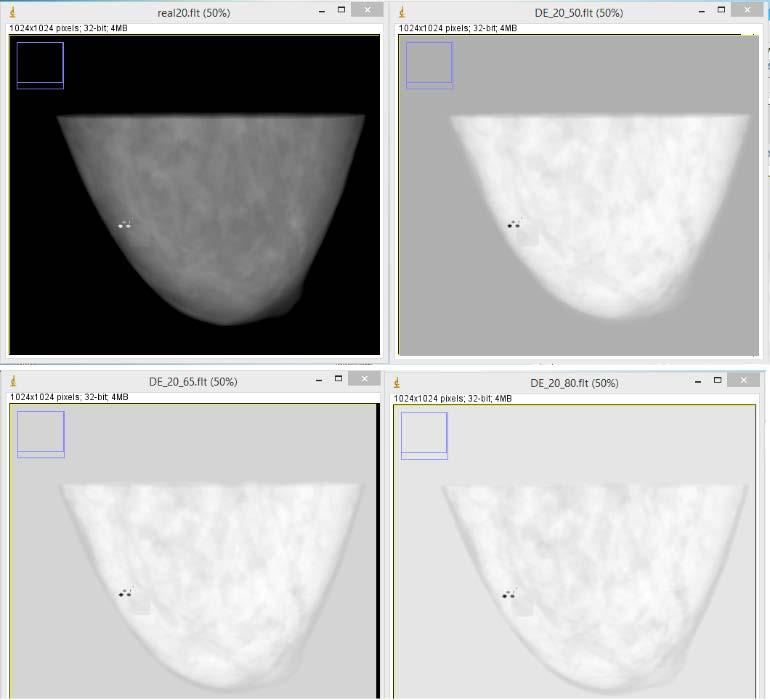 Work Project Example 1: Marius Laurikaitis and Anastasios Konstantinidis were working on the development of computational breast phantoms to be used in a virtual study, which aimed to determine the