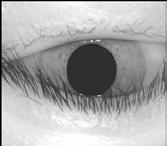Successfully detected iris boundary: (a) Eye image with light reflection, (b) Non uniform illumination eye image, (c) Eye image occluded by eyelash (d) Not properly open eye image, (e)-(h) Detected