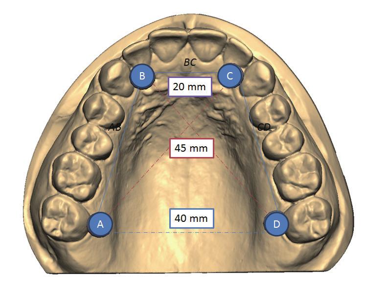 132 Scanning Accuracy of Dental Chairside and Laboratory CAD/ CAM Systems describes test methods used to evaluate the repeatability, reproducibility and accuracy of dental devices for 3-D