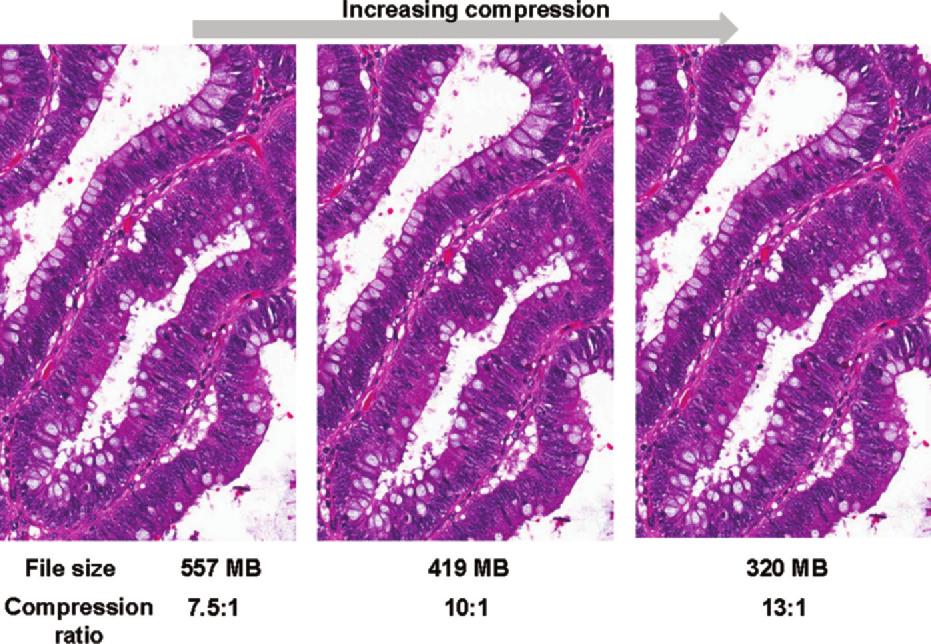 Figure 2. Effect of compression on image quality. A typical tissue section from an adenomatous polyp of the colon was scanned at 320 with varying compression levels.