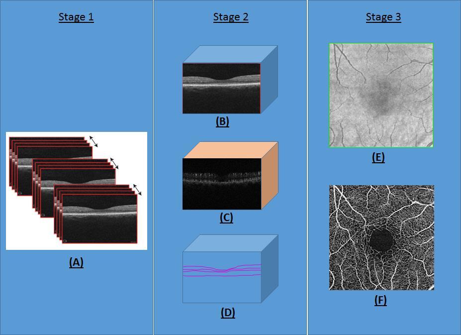 Supplement 197: Ophthalmic Optical Coherence Tomography for Angiographic Imaging StorageSOP Classes Page 25 Attribute Name Tag Type Attribute Description NO 225 C.8.xx.2.1 Ophthalmic OCT En Face Image Module Attribute Descriptions C.