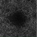 retina vasculature flow 290 Outer retina vasculature flow Choriocapillaris vasculature flow Choroid