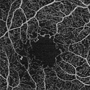 Supplement 197 Ophthalmic Optical Coherence Tomography for Angiographic Imaging StorageSOP Classes Page 52 520 Changes to NEMA Standards Publication PS 3.
