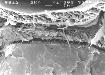 Adhesion to the surfaces of the lumina is good (right), and the cell walls exhibit the genuine