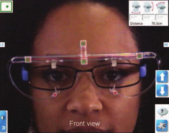 4 Adjust the patient s distance from the Visioffice, using the tracking detector until an acceptable distance is achieved. Correct Not Correct 5 Raise or lower the Camera to patient s eye level.