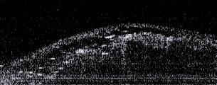 The images consist of 517 transverse and 400 axial pixels corresponding to 2mm and 1.4 in depth respectively. 4.2.3.