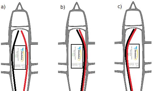 Figure 9 Way of placing current wires in the model: a) worst possible big loop,
