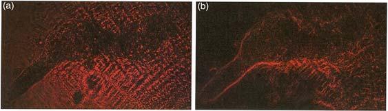 FIG. 5. Amoeba without voltage (a) and with voltage (b) on q-plate in 4f system Figure 5 demonstrates the edge-enhanced imaging capability for translucent media, such as biological samples.