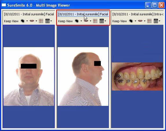Photos and X-rays Replace Images in the Multi Image Viewer Follow the steps below to replace photos, x-rays and DL images in the Multi Image Viewer.