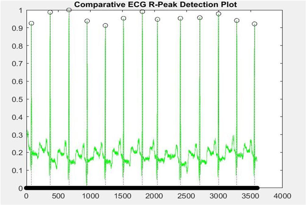 VI. CONCLUSION This paper proposes a low-cost ECG monitoring system which is portable and handy for the use in any environment, also it proposes steps for the analysis of the acquired ECG signal in a