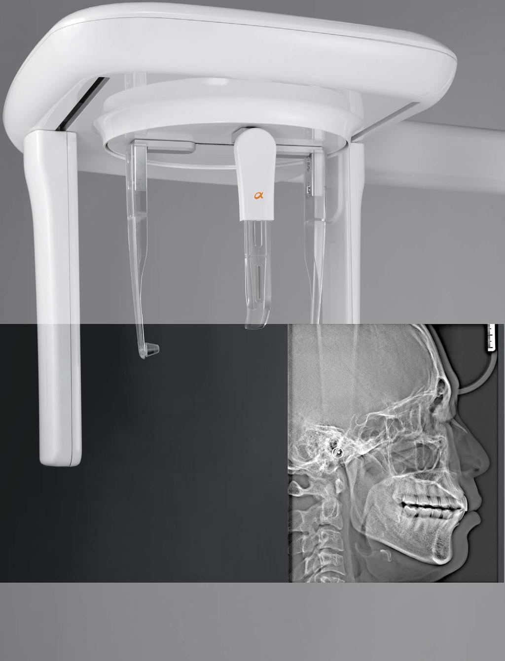 Proprietary CBCT reconstruction, Adaptive Moving Focus, and noise reduction technologies provide high quality images at optimized radiation exposure.