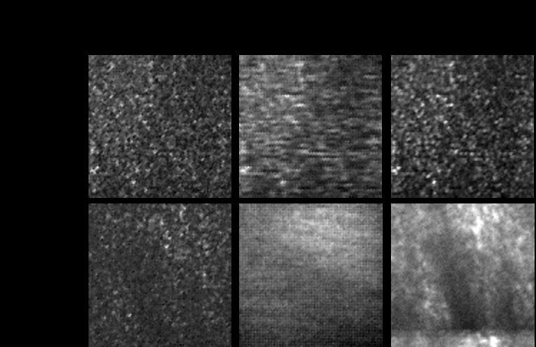 Figure 8.5 - Speckle tracking of tissue phantom and in vivo finger. Far left shows the first frame from a sequence of speckle images which were acquired while the sample was moving.