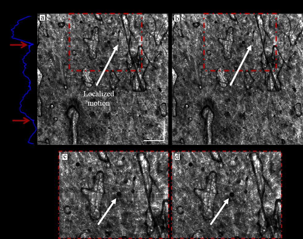 Figure 8.12 - Handheld ISAM with and without phase correction. En face projections from ISAM tomograms of healthy human skin with and without motion correction.