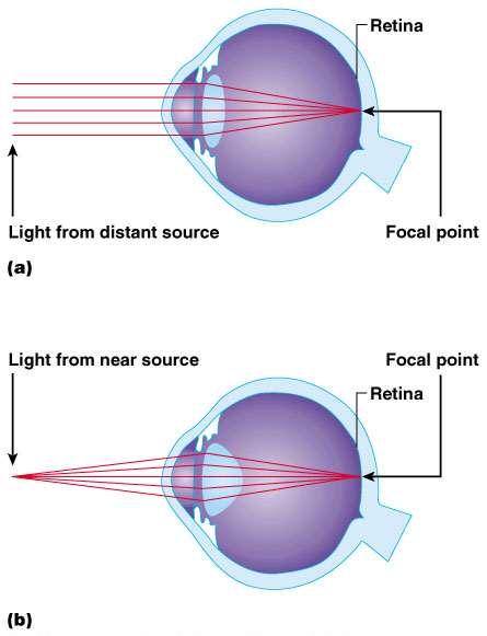 Accommodation Light must be focused to a point on the retina for optimal vision The eye is