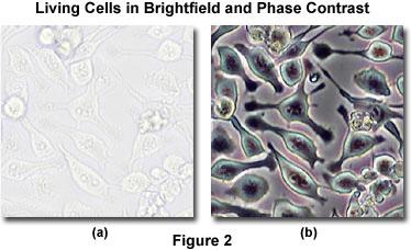 Phase contrast Useful for large magnifications (400 x ->) Useful when the sample is colorless or the details are