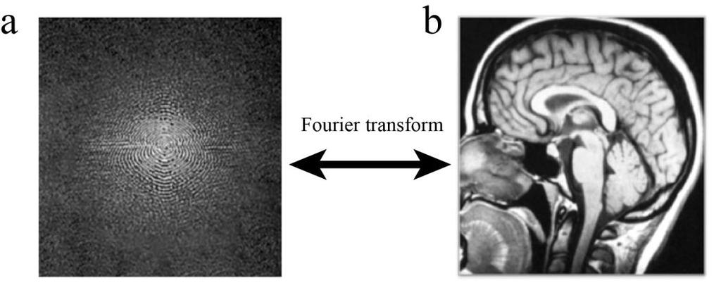 The frequency and phase information from the MRI signal corresponds to the k-space of the twodimensional (2D) Fourier transform of an image. That is, the data in the MRI is in the frequency domain.