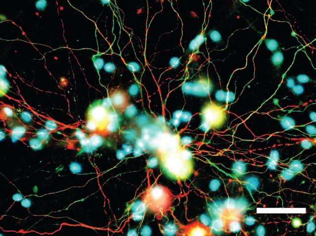 Fluorescence microscopy image of nerve cells cultured for 72 h on GaP nanowires.