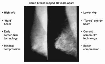 Mammography is a specialized form of