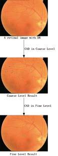 A New Secured Retinal Imaging System for Computer Aided Non-intrusive Diabetic Care 新一代安全可靠非侵入式糖尿病監護的視網膜圖像系統 Professor YOU Jia Jane csyjia@comp.polyu.edu.